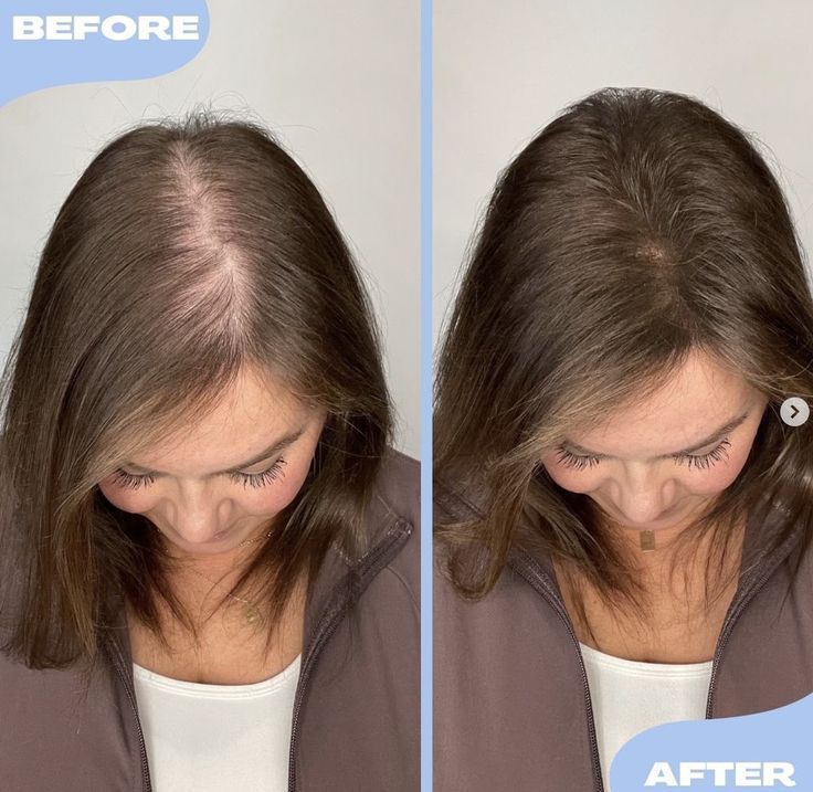 FEG Plus Hair Growth Spray 50ml | Anti-Hair Loss & Regrowth Solution (Original)